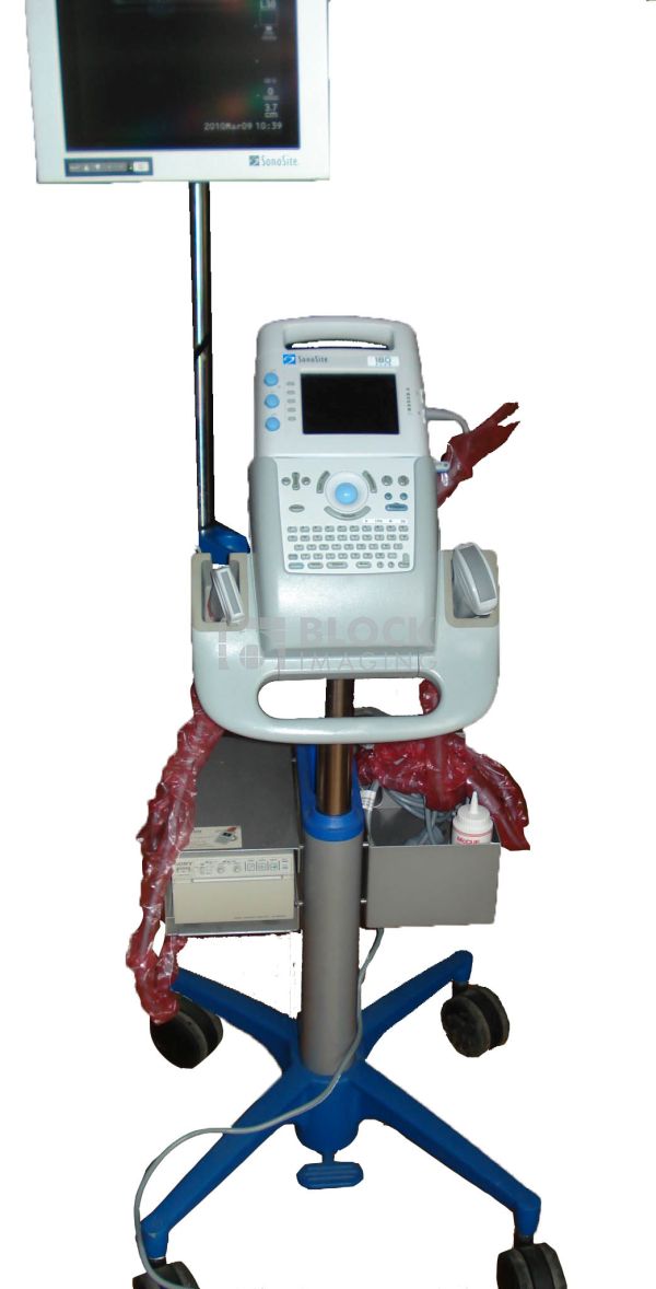 SonoSite 180 Plus Ultrasound