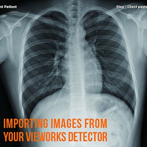 How to Import Images from Your Vieworks DR Panel