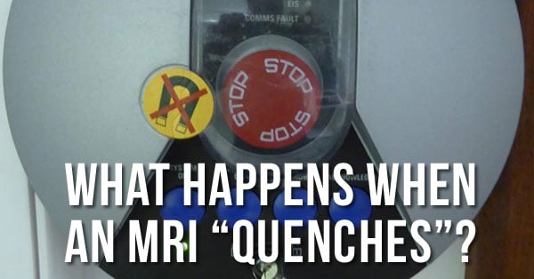 ¿QUÉ ES UNA RM QUENCH?