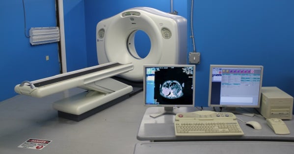 Correcting CT Scanner Streak Artifacts